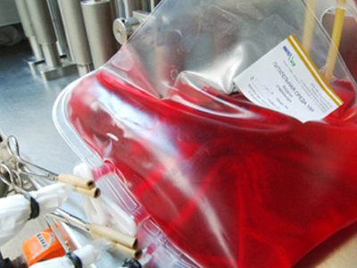 Η υπόθεση με το πλάσμα χρονολογείται από το 2002