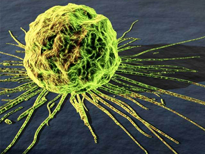 Τροποποιείται η θεραπεία για τον καρκίνο του προστάτη