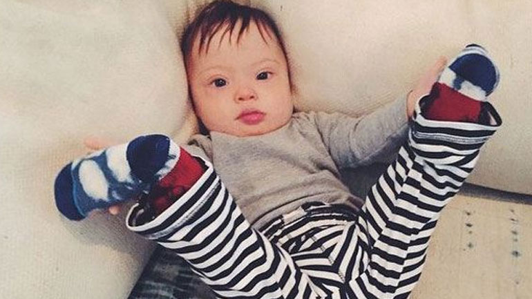 Αγοράκι με Σύνδρομο Down κάνει καριέρα στο μόντελινγκ