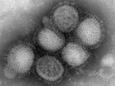 SEXUALITY: Η συσχέτιση του Η1Ν1 με σύνοδες παθήσεις