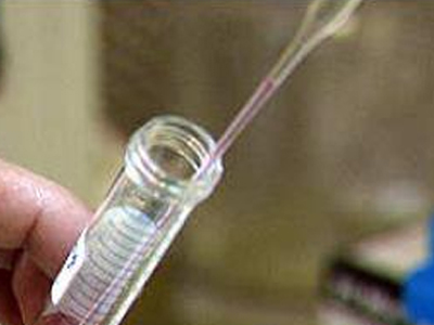 Γονιμότητα:  Πώς θα μπορούσα να αυξήσω την κινητικότητα των σπερματοζωαρίων;