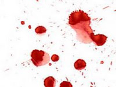 SEXUALITY: Κατά τη σεξουαλική επαφή, αιμορραγώ…