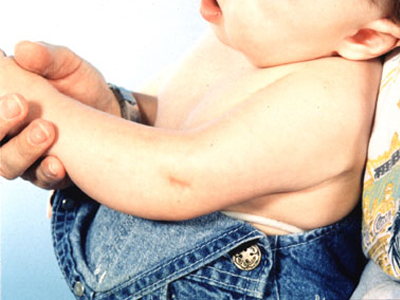 SEXUALITY: Ένα ένζυμο, μία βιταμίνη και ο σχηματισμός των γεννητικών οργάνων