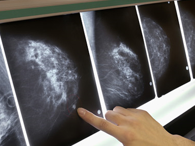 SEXUALITY: Πόσο «επικίνδυνη» μπορεί να είναι η διάγνωση καρκίνου στον άνδρα;