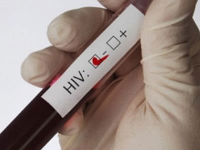 Νέα κατ’ οίκον εξέταση για τον HIV ένα βήμα πριν την έγκριση