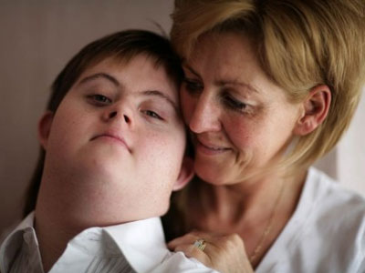 Γονιμότητα: Παγκόσμια ημέρα για το σύνδρομο «Down»