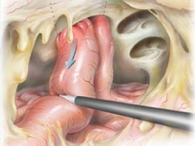 SEXUALITY: Πριν ένα χρόνο έκανα εγχείρηση κιρσοκήλης, μπορώ να τεκνοποιήσω;