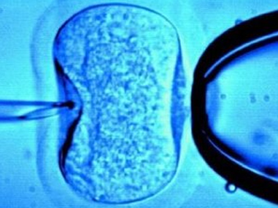 Γονιμότητα: Οι οργανικές ανωμαλίες είναι συχνότερες στα παιδιά που γεννιούνται μετά από εξωσωματική γονιμοποίηση!