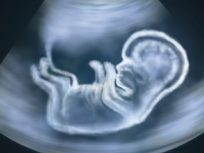 Γονιμότητα: Τεχνητή μεμβράνη από βλαστοκύτταρα επιδιορθώνει την πρόωρη ρήξη υμένων