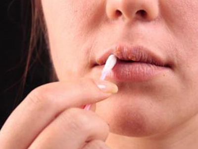 SEXUALITY: Μπορεί το στοματικό σεξ να προκαλέσει έρπητα;