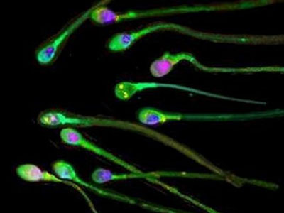 Τι προβλέπεται για τα καταψυγμένα σπερματοζωάρια ενός άνδρα μετά το θάνατο του