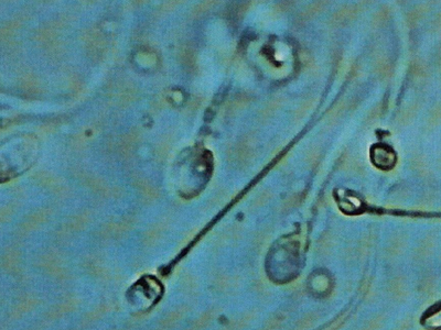 Γονιμότητα: Εξωσωματική γονιμοποίηση χωρίς φαρμακευτική αγωγή- 3ο Στάδιο: Γονιμοποίηση και καλλιέργεια εμβρύων