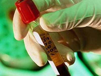 SEXUALITY: Η ηπατίτιδα C και ο καρκίνος των νεφρών