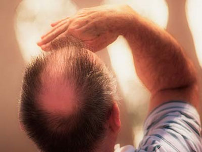 SEXUALITY: Σχετικά με την πρώιμη εμφάνιση της… φαλάκρας!