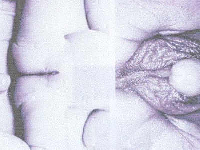 SEXUALITY: Κρυψορχία