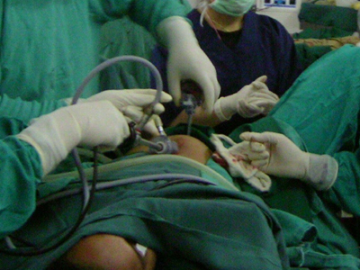 Γονιμότητα: Πώς θα αισθάνομαι μετά από επέμβαση λαπαροσκόπησης;