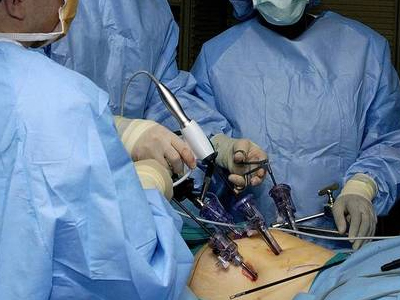 Γονιμότητα: Ποια ινομυώματα χειρουργούνται λαπαροσκοπικά