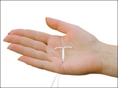 Γονιμότητα: Ενδομητρικό σύστημα με συνθετική προγεστερόνη (Mirena)