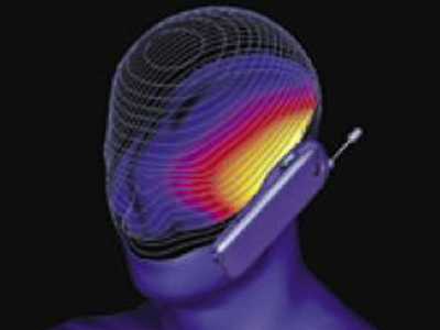 Γονιμότητα: Ο κίνδυνος των κινητών τηλεφώνων