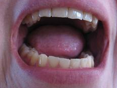 SEXUALITY: Μπορεί να είναι από στοματικό σεξ;