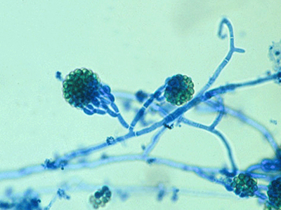 SEXUALITY: Έχω μια πληγή. Τι μπορεί να είναι;