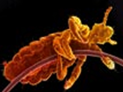 SEXUALITY:  Οι φθείρες κεφαλής και εφηβαίου μεταδίδονται;