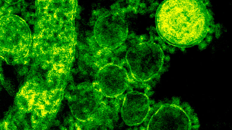 Ένα κρούσμα του MERS σήμερα στη Ν. Κορέα – Στους 24 οι νεκροί