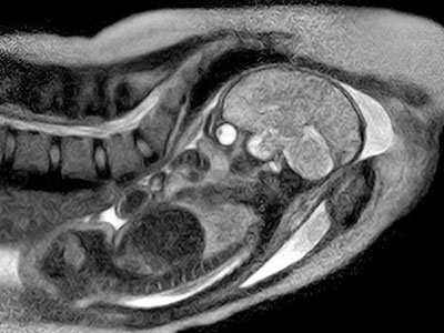 Γονιμότητα: Μια εντελώς πρωτοποριακή γέννα!