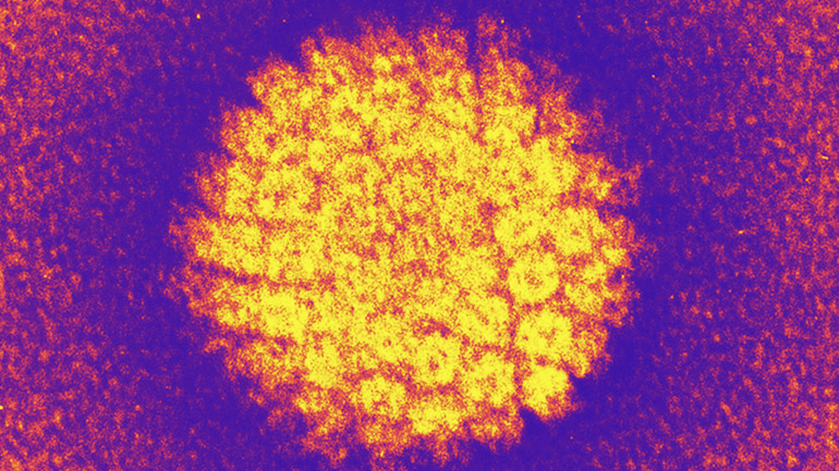 Νέα στοιχεία για τον τρόπο μετάδοσης του HPV