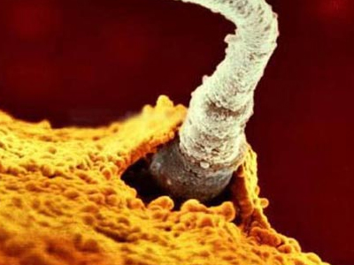 SEXUALITY: Η μυστηριώδης πορεία του σπερματοζωαρίου προς το ωάριο