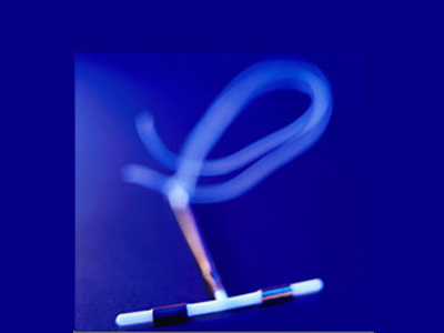 Γονιμότητα: Πόσο ασφαλές είναι το σπιράλ;