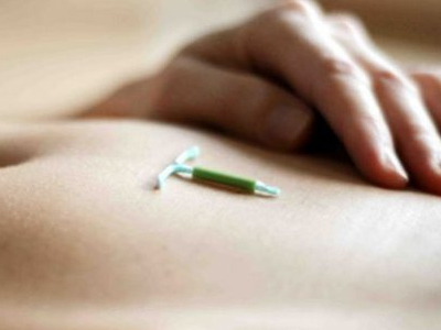 Γονιμότητα: Μπορεί να μείνει έγκυος μία γυναίκα που φοράει σπιράλ;