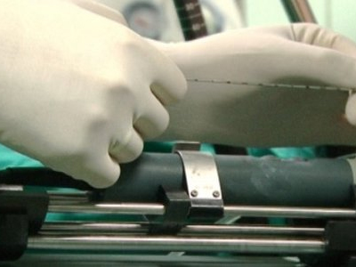 SEXUALITY: Τι μπορώ να κάνω με τον προστάτη;