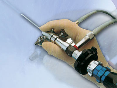 Γονιμότητα:  Γυναικολογικές επεμβάσεις: Διαγνωστική υστεροσκόπηση