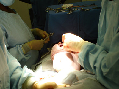 SEXUALITY: Βλαστοκύτταρα – μεσεγχυματικά κύτταρα