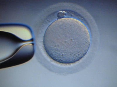 Γονιμότητα: Έχουν δικαίωμα οι γυναίκες να πωλούν τα ωάριά τους;