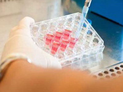 Το ύπουλο σύμπτωμα της αιματουρίας