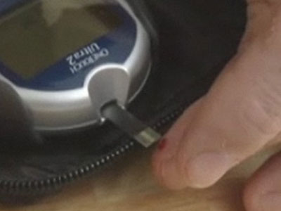 Ο εντατικός έλεγχος του σακχάρου μειώνει την πιθανότητα ΣΔ