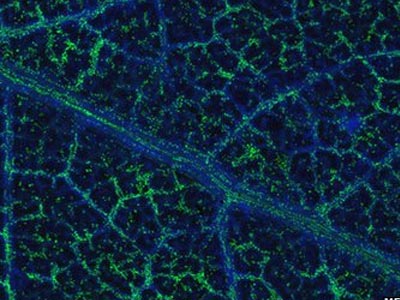 Κοιτάσματα χρυσού στις ρίζες δέντρων ευκαλύπτου(;)