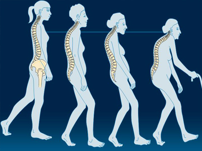Εβδομάδα Πρόληψης Οστεοπόρωσης στον  Κορυδαλλό