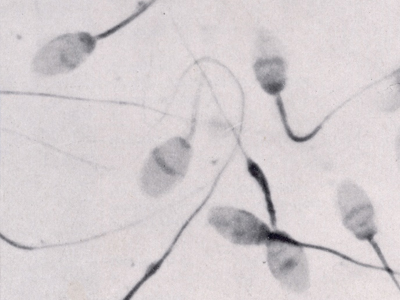 SEXUALITY: Χρήση υπερήχων για αντισύλληψη στους άνδρες