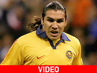 Πυροβόλησαν στο κεφάλι Παραγουανό ποδοσφαιριστή Πυροβόλησαν στο κεφάλι Παραγουανό ποδοσφαιριστή