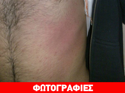 Καταγγελία για άγριο ξυλοδαρμό κρατούμενου μετανάστη στην Κόρινθο Καταγγελία για άγριο ξυλοδαρμό κρατούμενου μετανάστη στην Κόρινθο