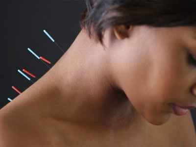 «Υγεία & Ευεξία με τη μέθοδο του Βελονισμού»