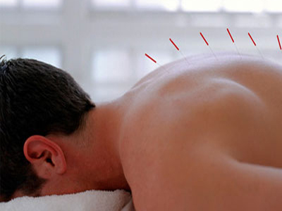 Παγκόσμιο Συνέδριο Ιατρικού Βελονισμού στην Αθήνα