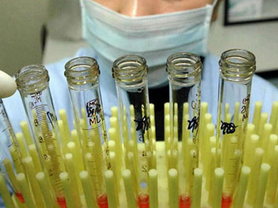 Γονιμότητα: Βλαστοκύτταρα, επένδυση ζωής ή ακόμα μία τράπεζα;