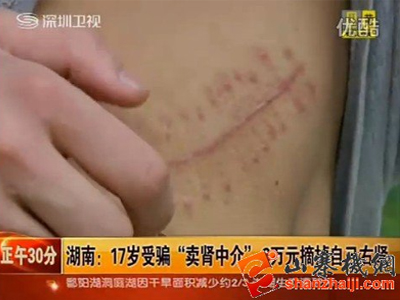 Κίνα: Έναρξη της δίκης για την υπόθεση της αγοράς iPad μετά από πώληση νεφρού