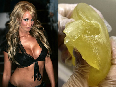 Αντιμέτωπη με τον εφιάλτη της PIP