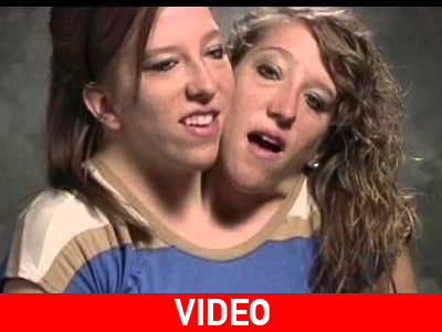 Η.Π.Α.: Reality για… σιαμαίες αδερφές