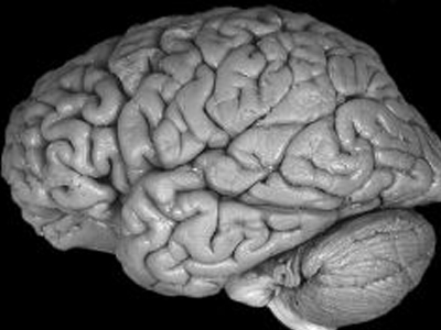 Ελπίδες για την καταπολέμηση του Alzheimer